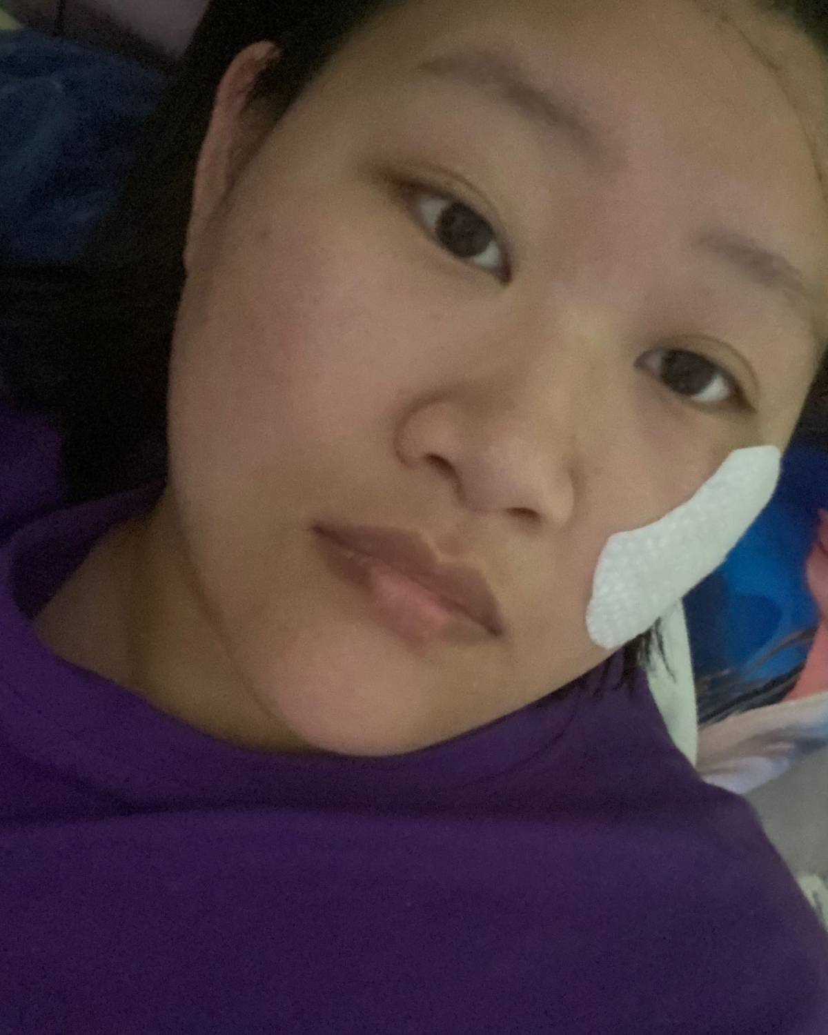 ⚠️⚠️⚠️肌绕道（PS：正处于烂脸的也不能刷酸） ✅首先，