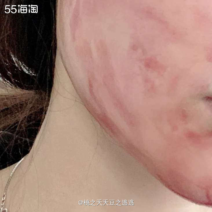 面膜打卡第4天，今天我是吸血的红色～the ordinary