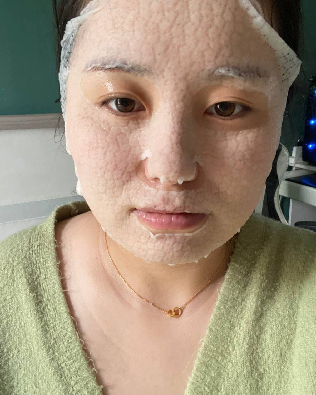 🌟 国产面膜—福瑞达颐莲玻尿酸面膜，富含神经酰胺具有修护、