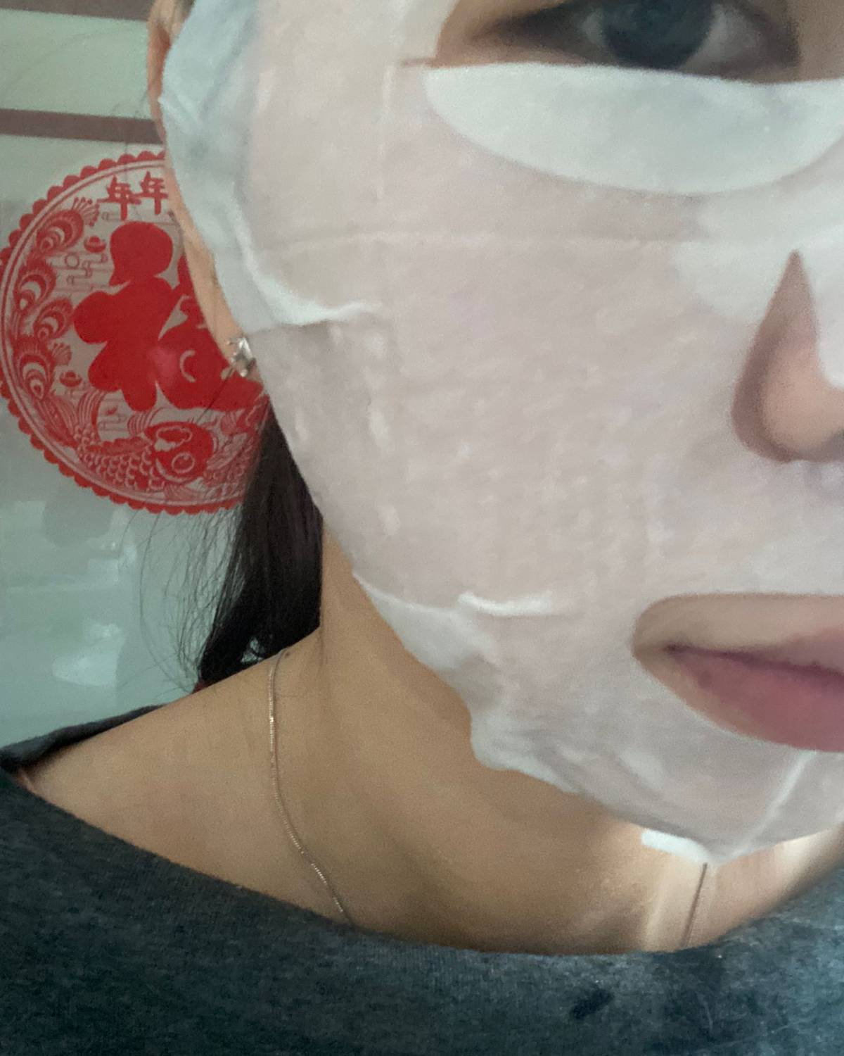 前段时间去做了调Q激光，把脸上多年的雀了，当时是叫我去买用面