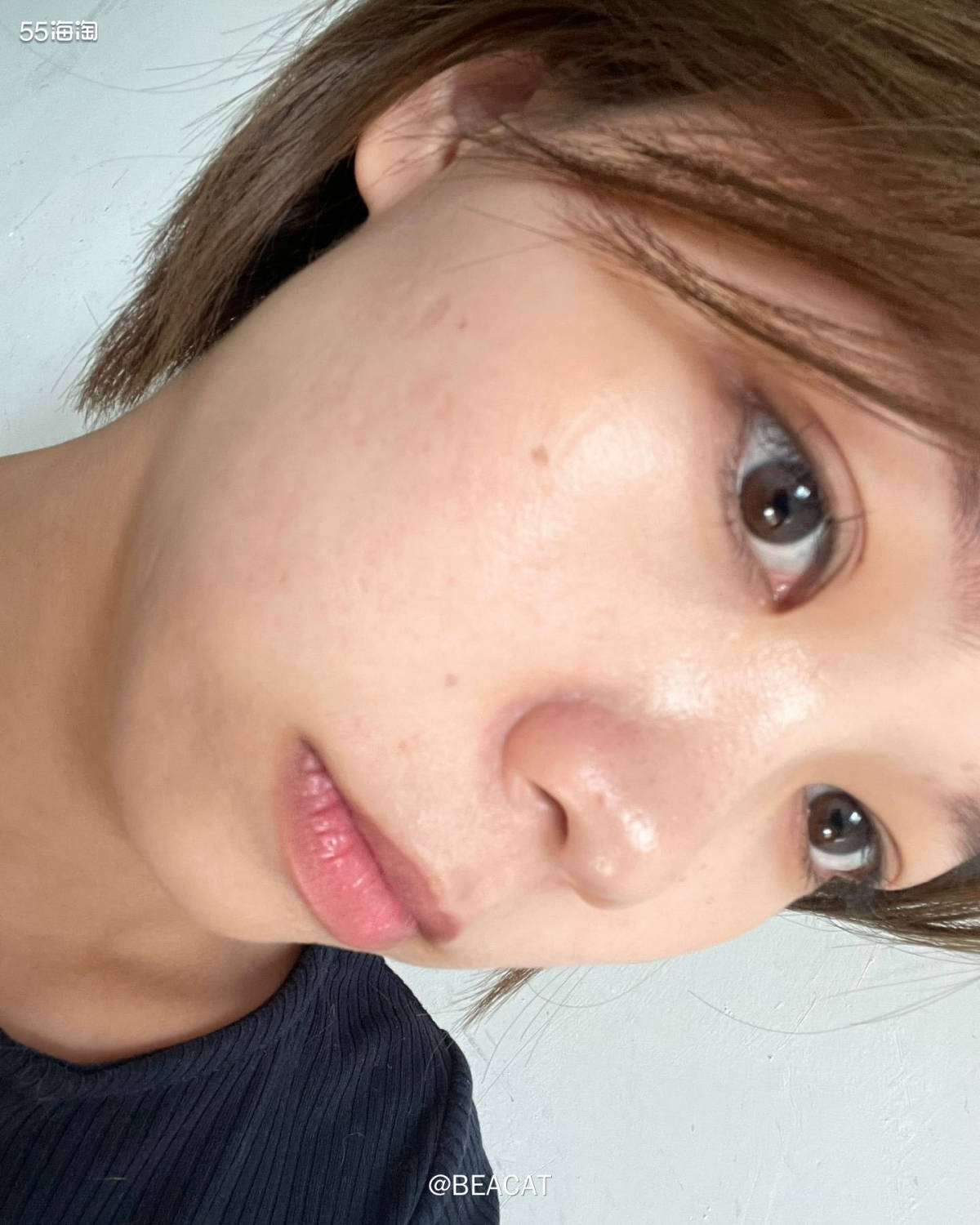 在我25岁的时候我开始接触了光子，脸上用了很多种精华，但是总
