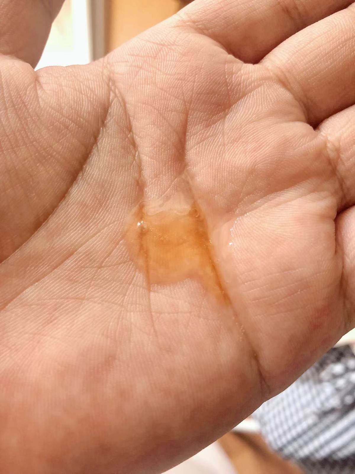 🔑作为一个资深油皮，精华都只能战战兢兢的选择没什么功效的水