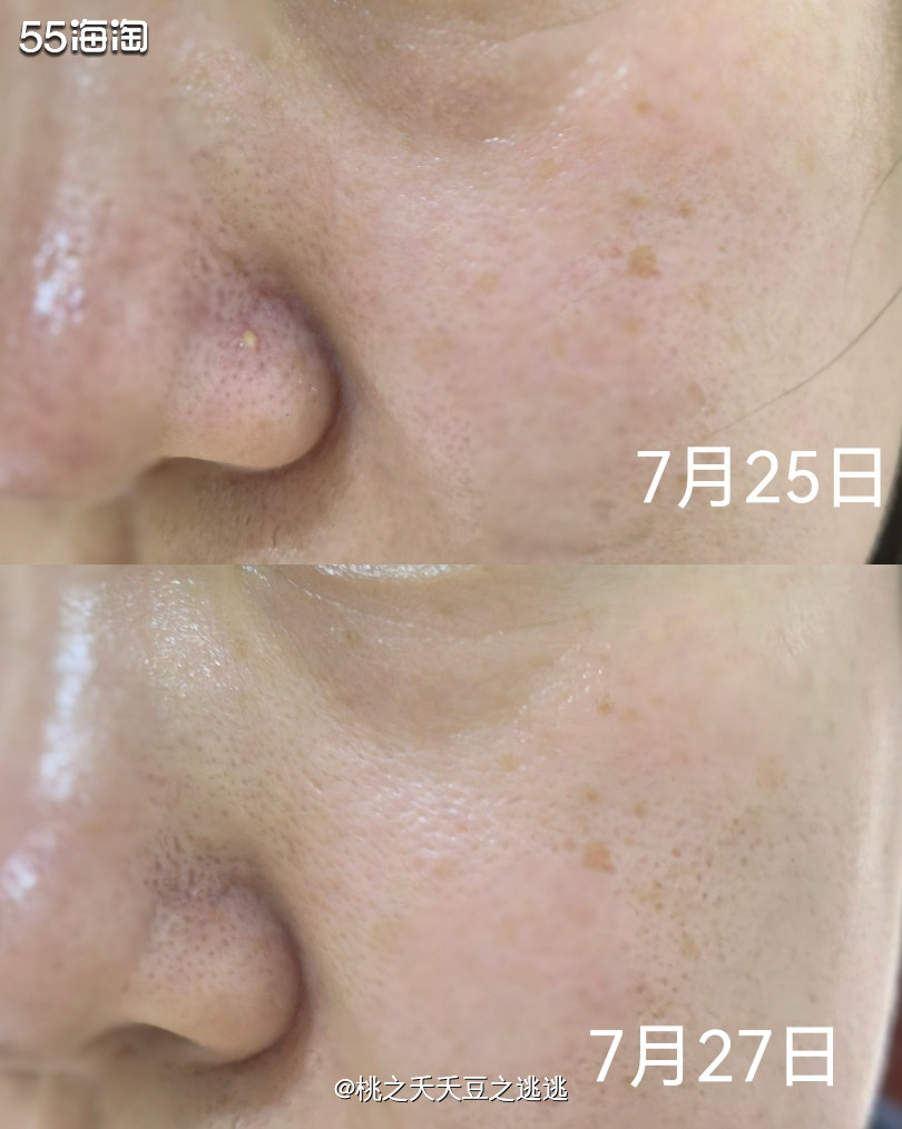 💛终于收到了Ameliorate的产品，很开心能成为有幸试