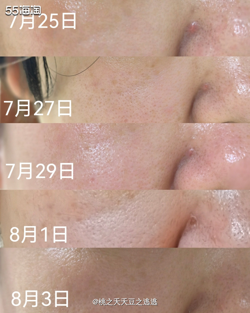 💛终于收到了Ameliorate的产品，很开心能成为有幸试