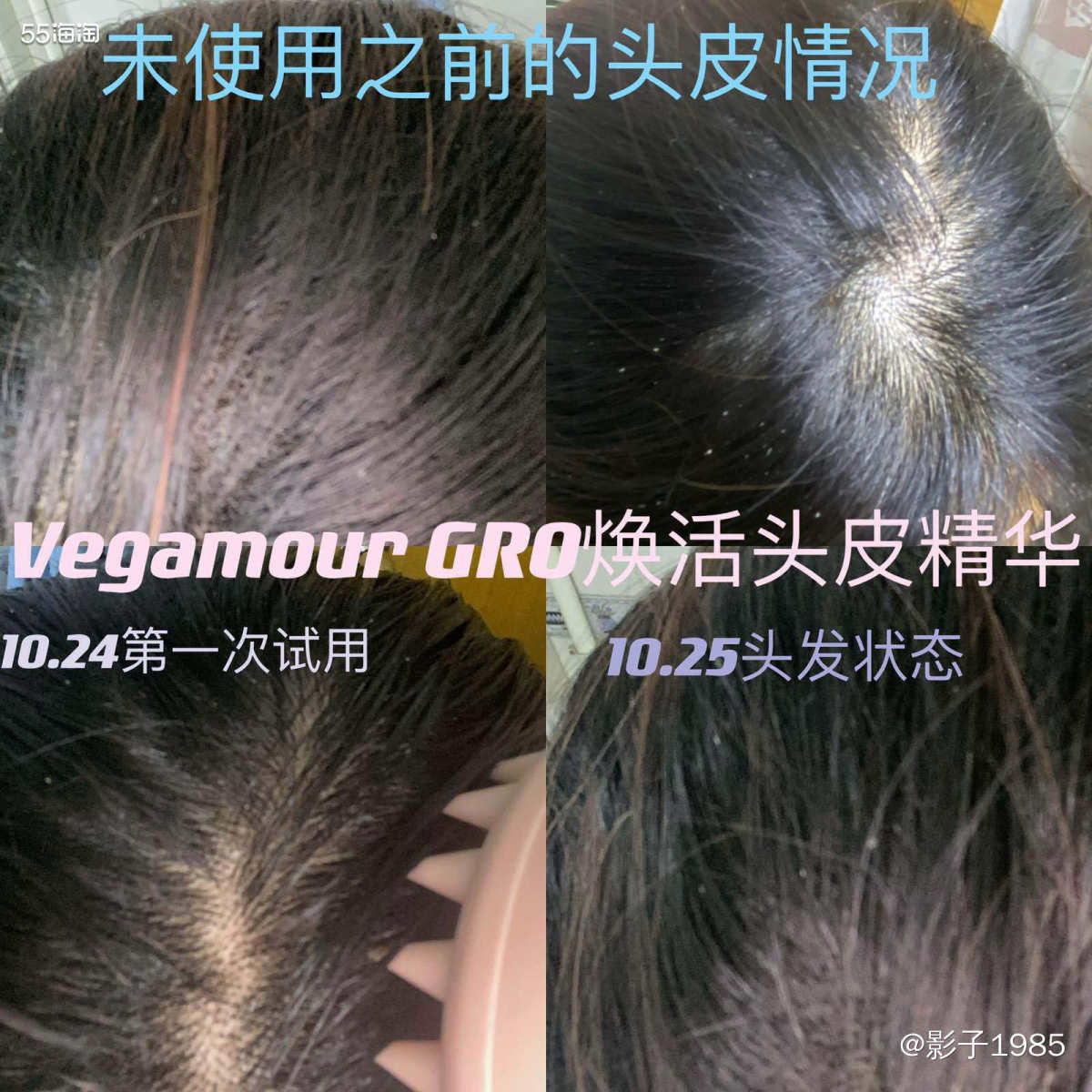 我是属于干性皮肤，随着年龄的增长，关注的不仅仅是皮肤的健康护