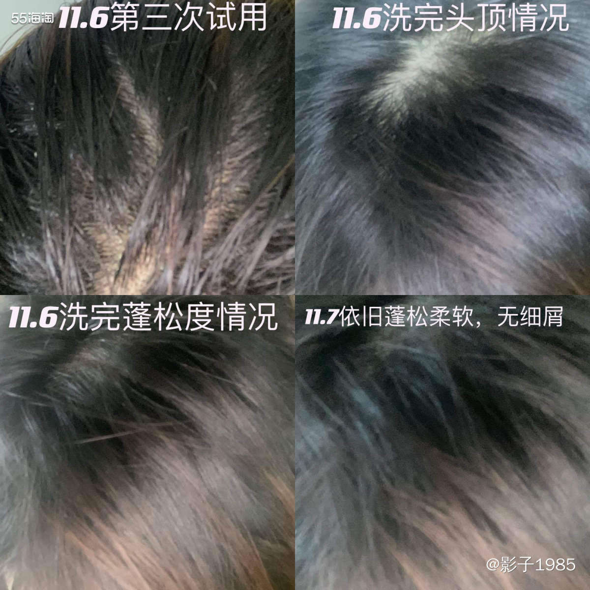 我是属于干性皮肤，随着年龄的增长，关注的不仅仅是皮肤的健康护