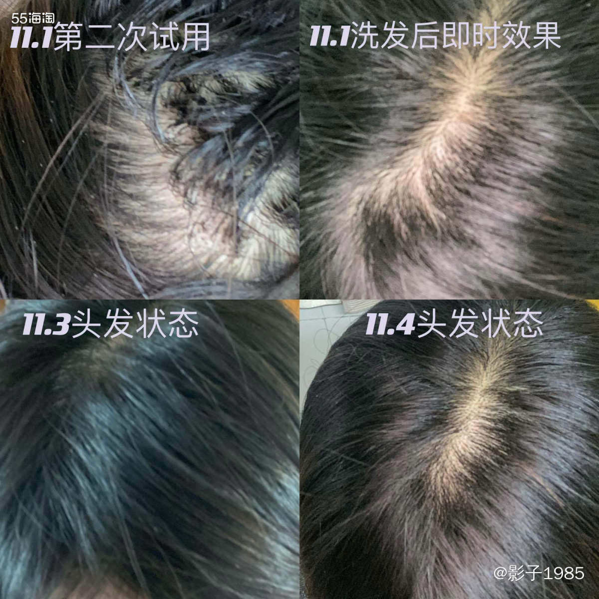 我是属于干性皮肤，随着年龄的增长，关注的不仅仅是皮肤的健康护