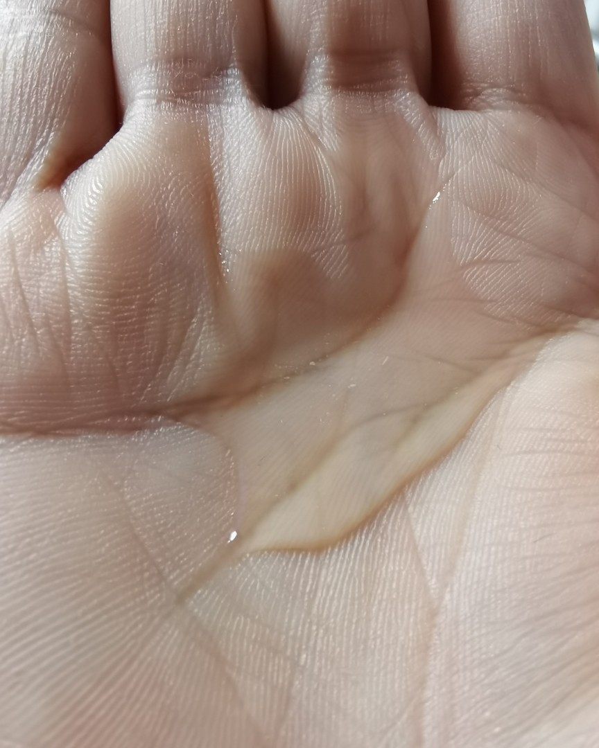 ✅曾经我是头发茂密的混油皮，每年为头发太多而烦恼，结果，岁月