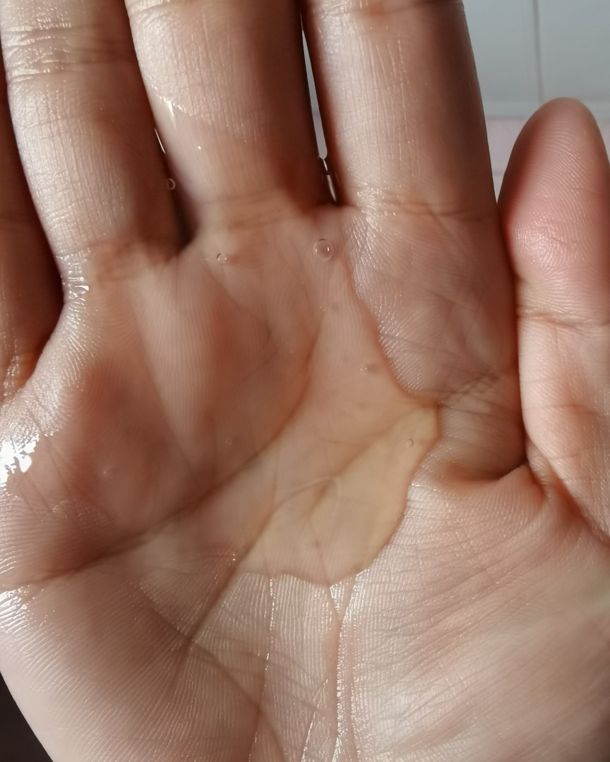✅曾经我是头发茂密的混油皮，每年为头发太多而烦恼，结果，岁月