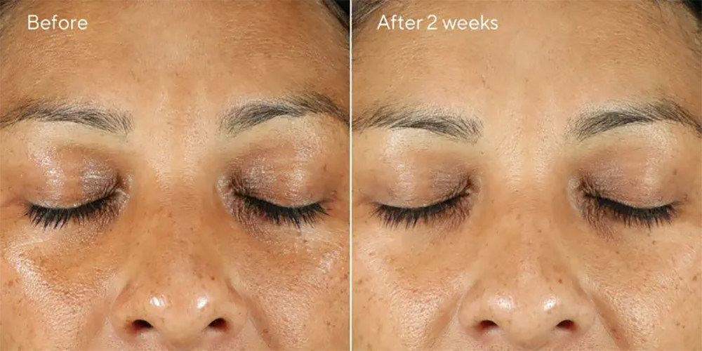 ✡️计划购买网站：Murad慕拉（美国） ❤️Murad 是