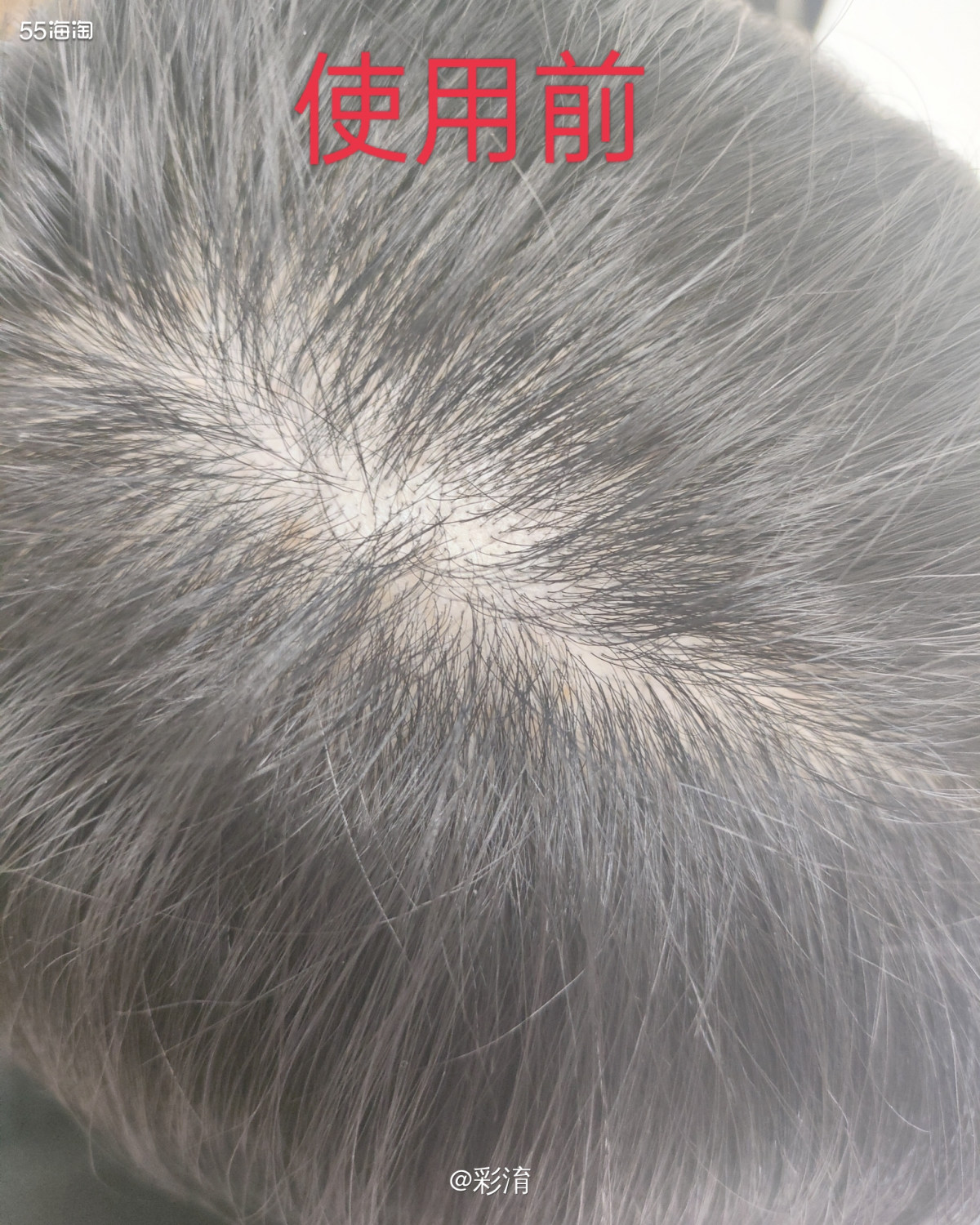 真的很开心在Vegamour GRO产品试用的活动中有幸的被
