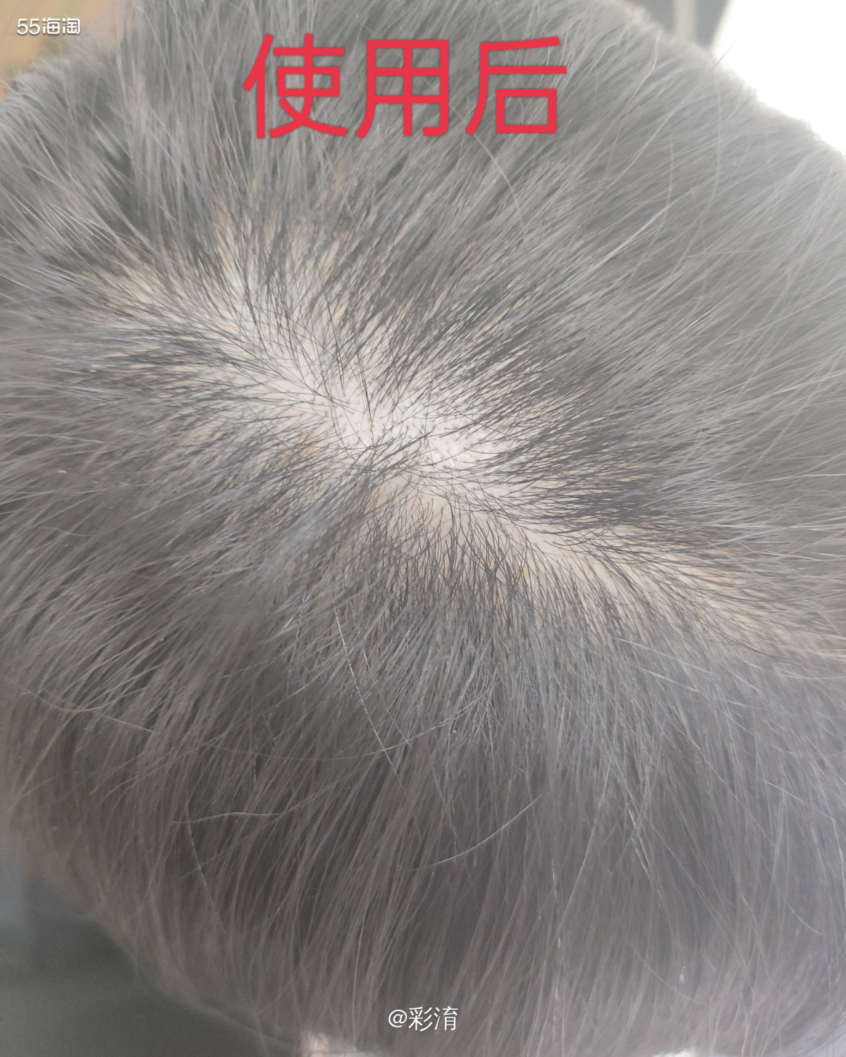 真的很开心在Vegamour GRO产品试用的活动中有幸的被