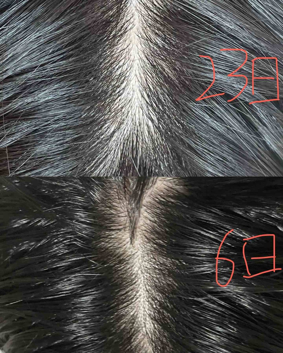 👉品牌介绍：VEGAMOUR是风靡欧美的头皮头发养护品牌。