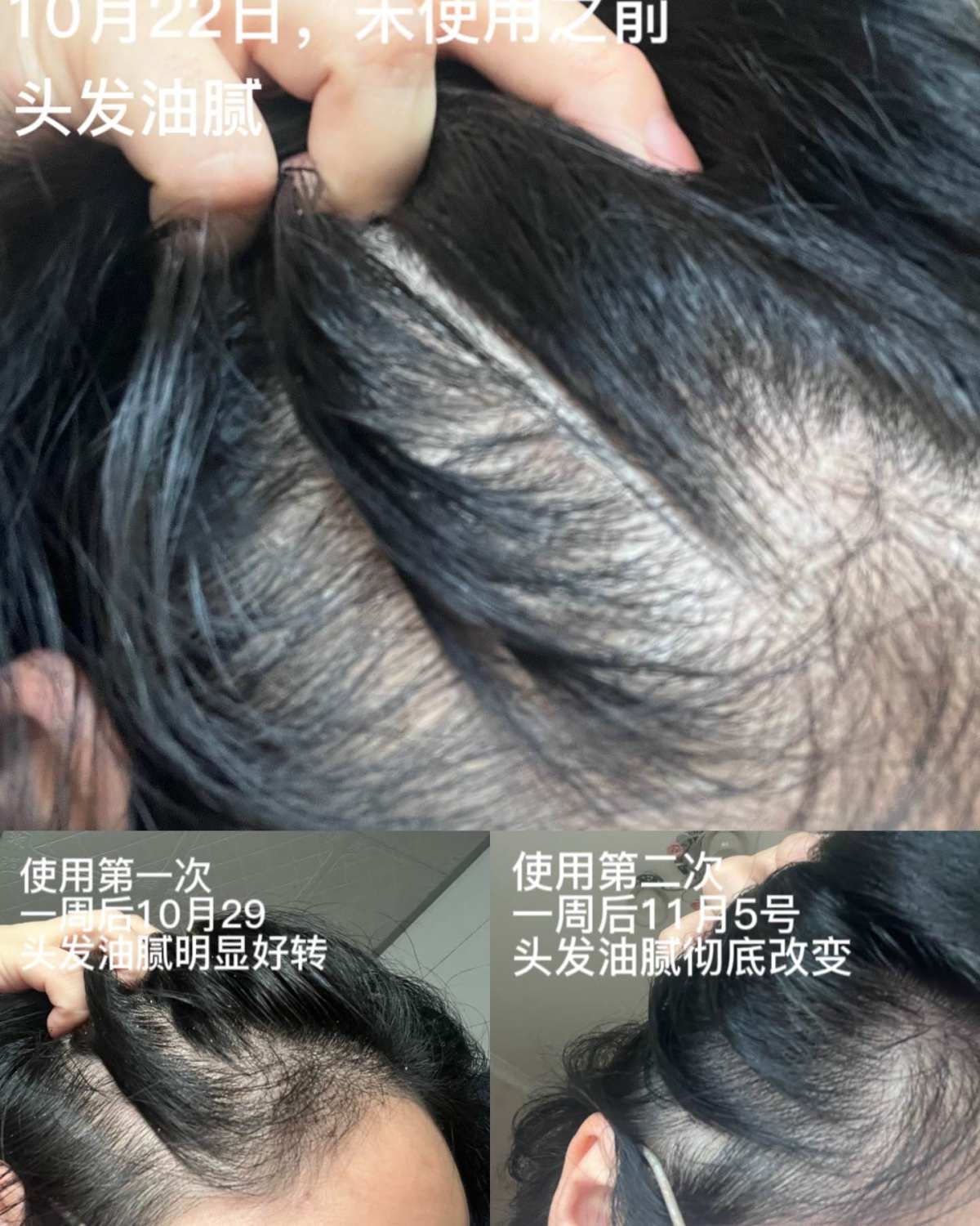 【品牌】VEGAMOUR是风靡欧美的头皮头发养护品牌。为不同