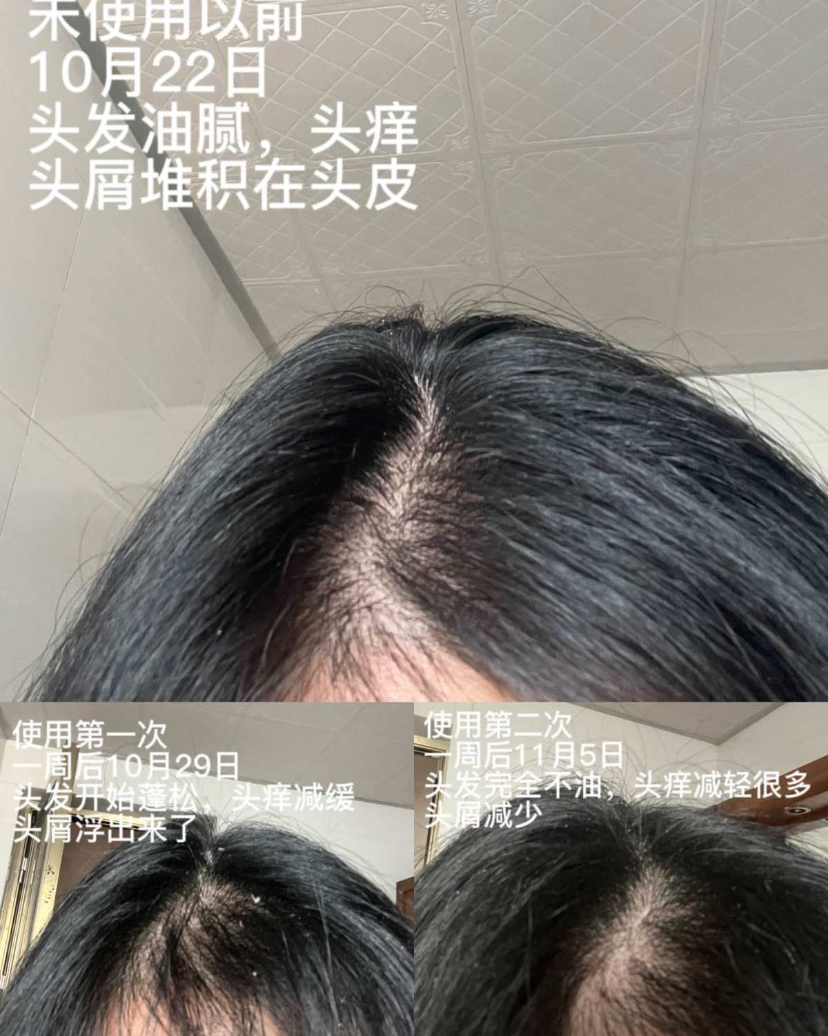 【品牌】VEGAMOUR是风靡欧美的头皮头发养护品牌。为不同