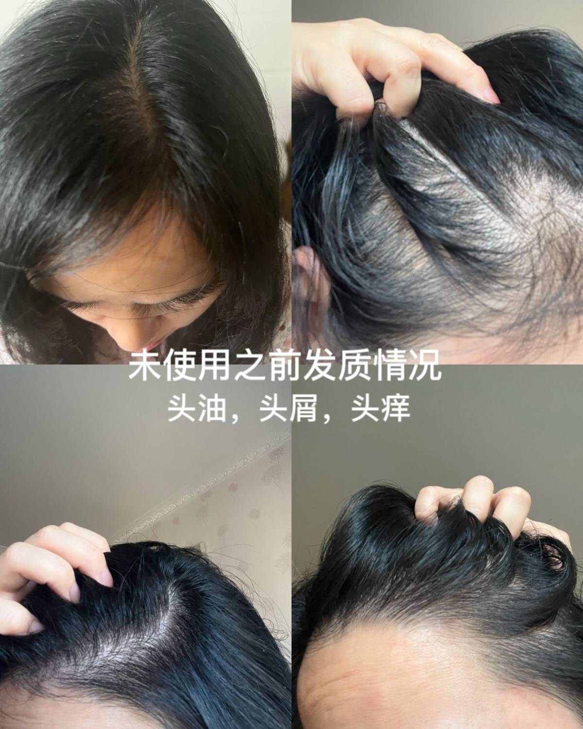 【品牌】VEGAMOUR是风靡欧美的头皮头发养护品牌。为不同