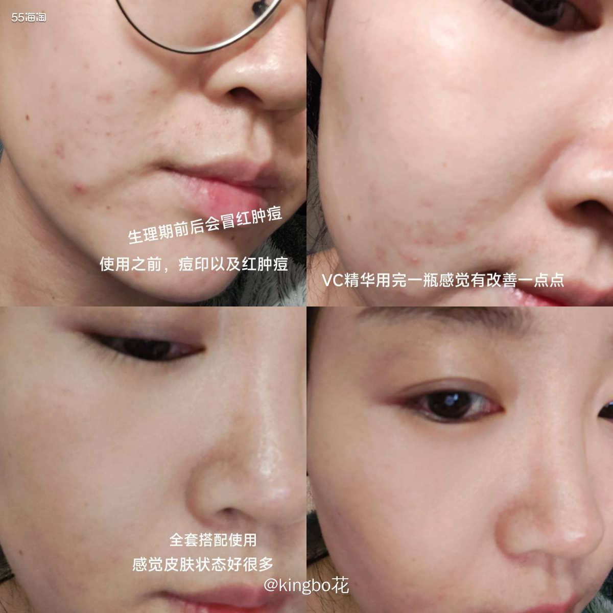 ⏺裴礼康三件套试用评测来啦，面霜精华肤感都很不错哦  🔷距
