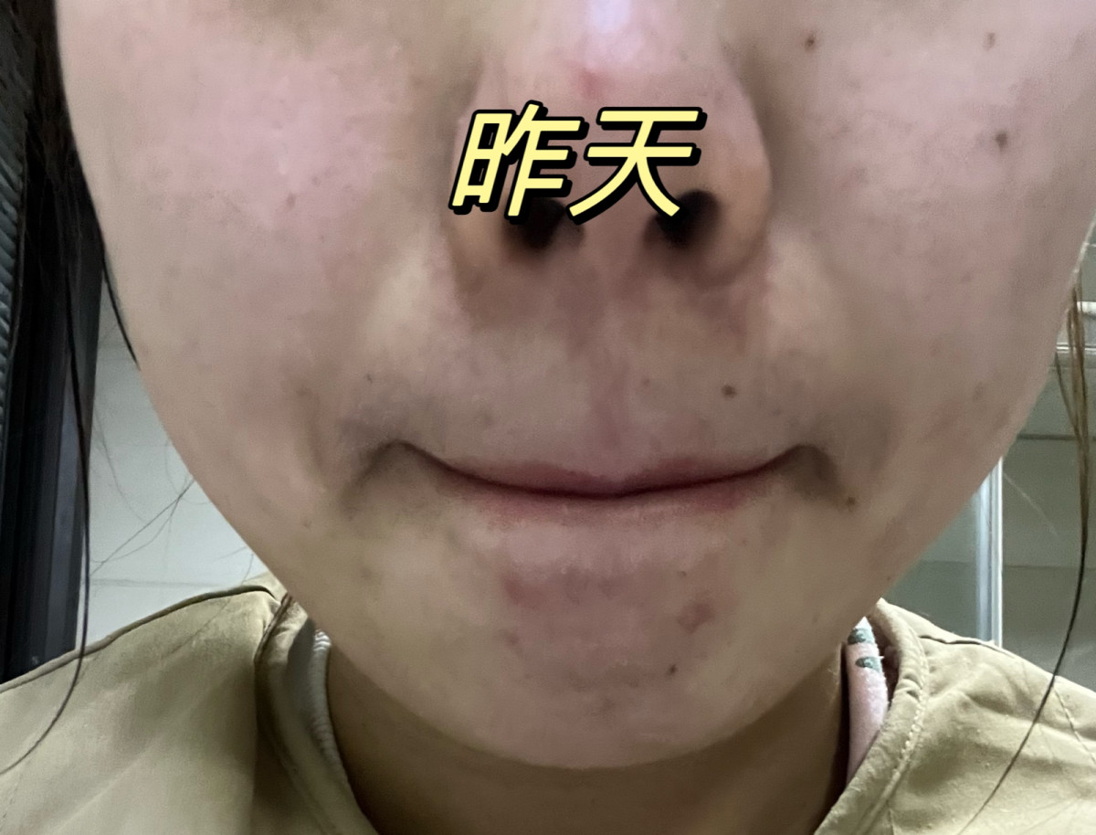 新年快乐呀各位宝宝！在12月底收到了来自55的裴礼康正装爽肤