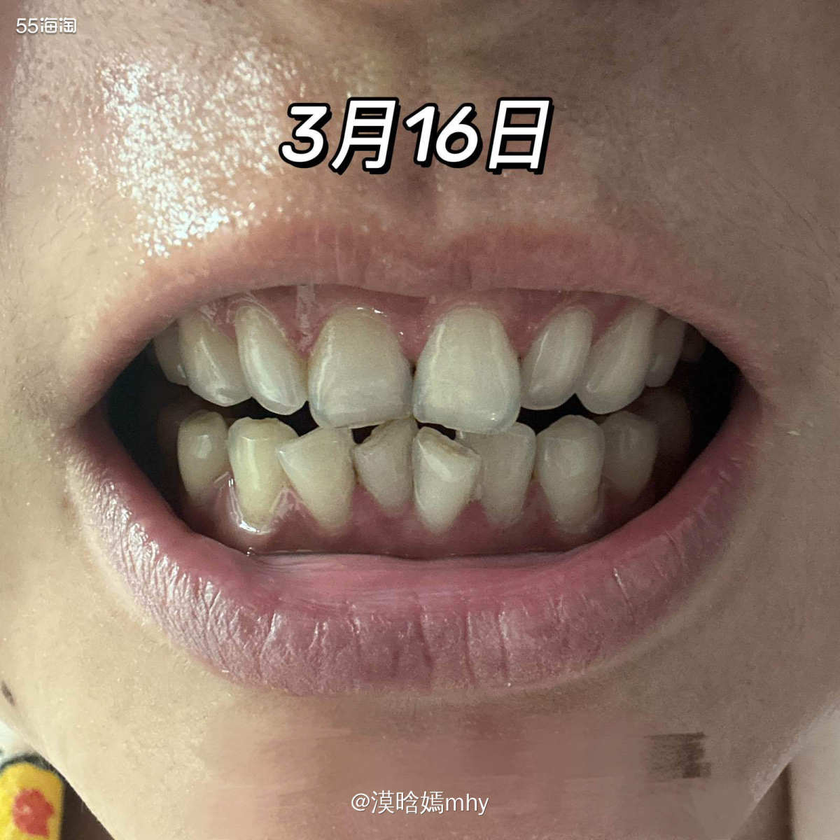 💐这次很开心被55海淘选中成为试用SNOW冷光美牙仪试用测