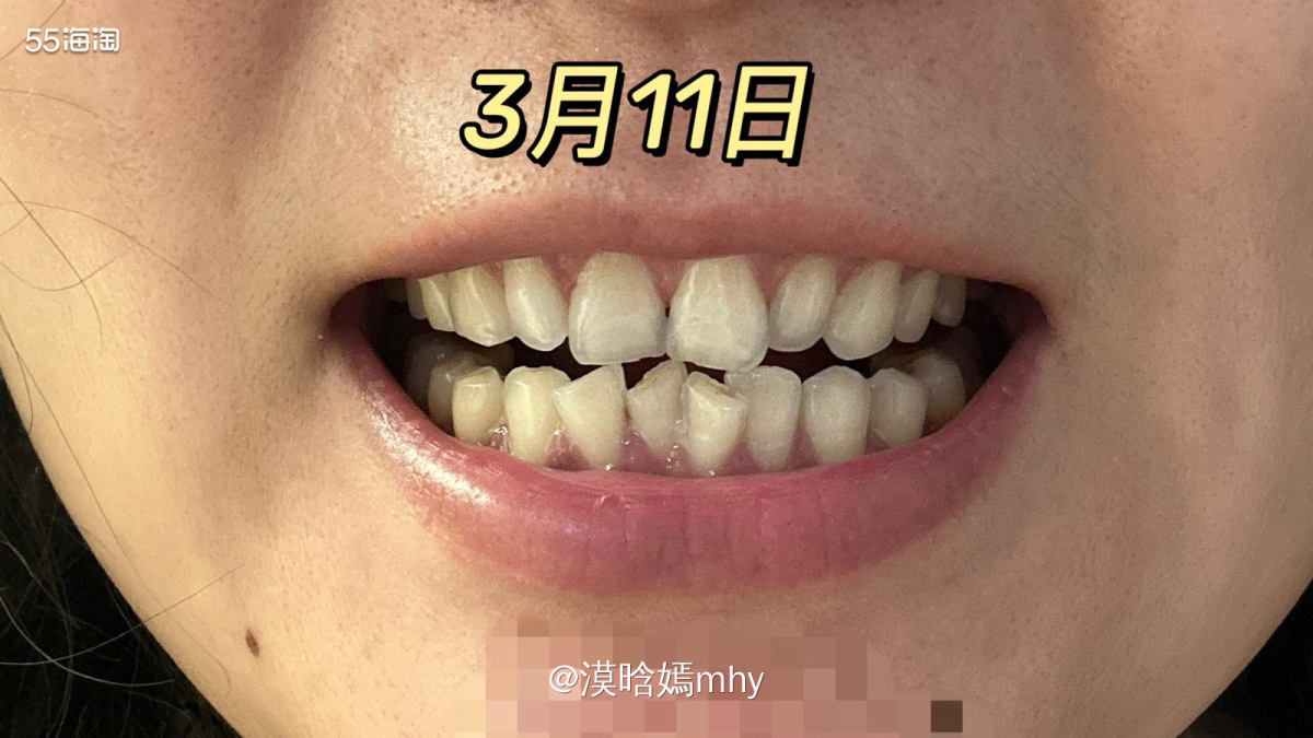 💐这次很开心被55海淘选中成为试用SNOW冷光美牙仪试用测