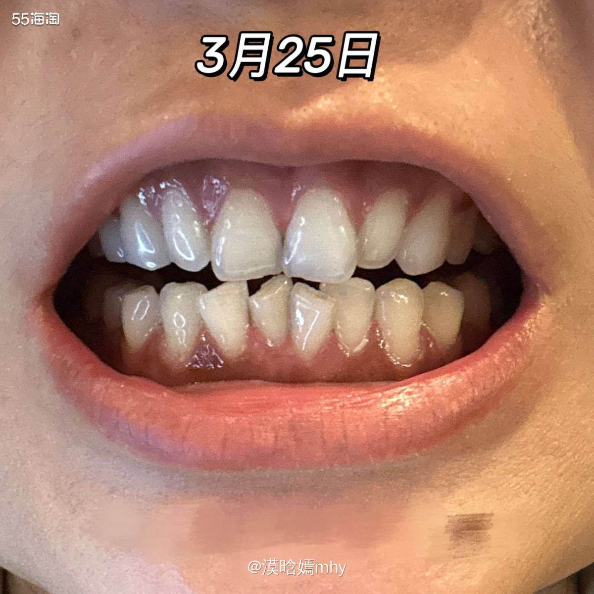 💐这次很开心被55海淘选中成为试用SNOW冷光美牙仪试用测