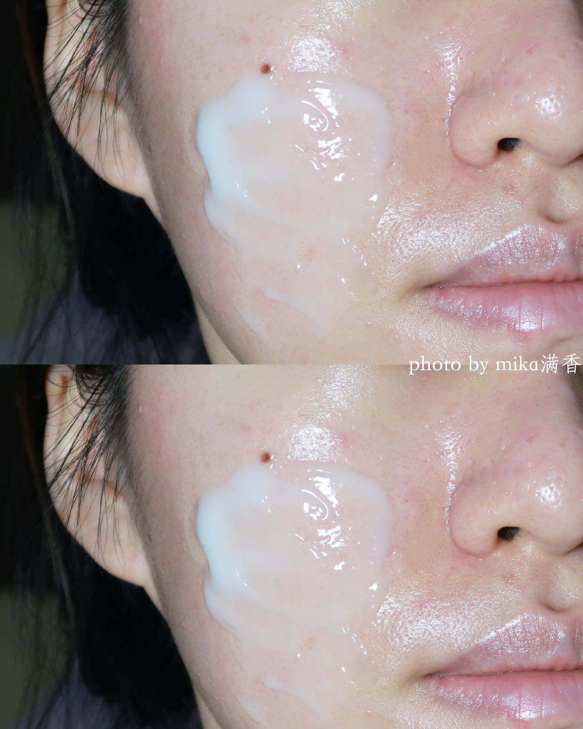换季交接的时候皮肤很不稳定啊 看看我这一脸的小疙瘩 赶紧把清