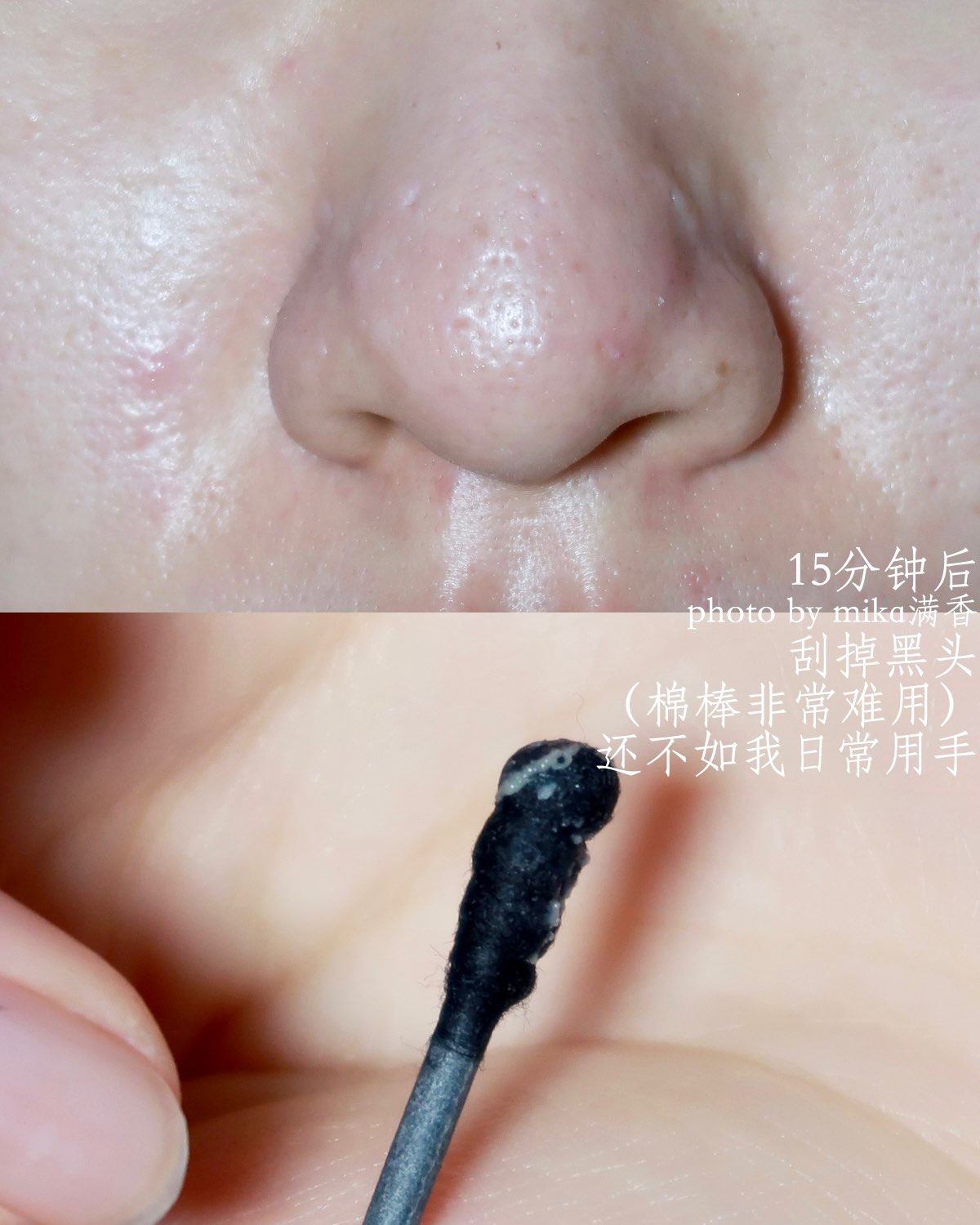 又是一次不信xie的尝试 感觉所有对去黑头鼻贴和冻膜的评价 