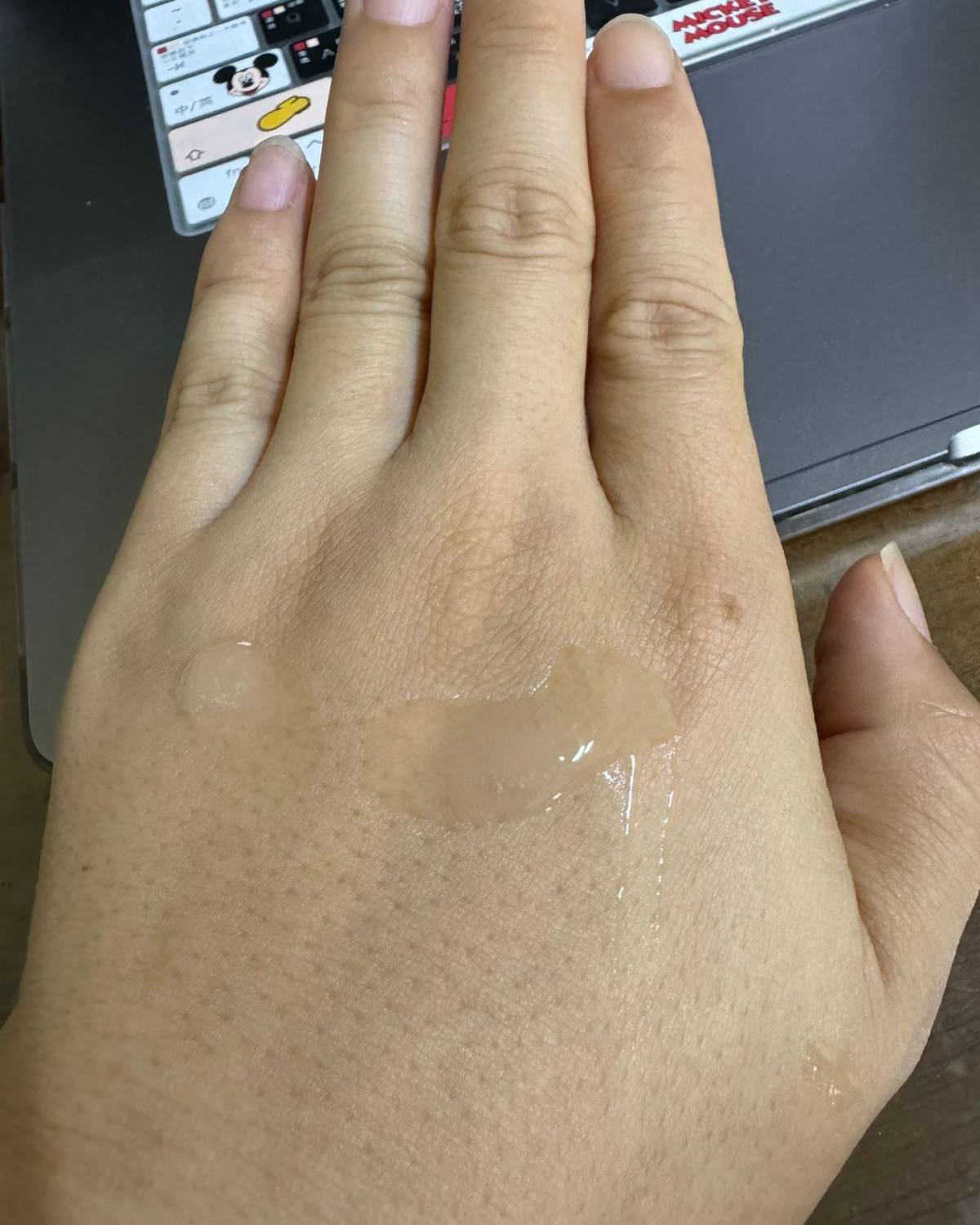之前的帖子有提到过突发奇想给手上涂资生堂黑腰子，过了两三周手