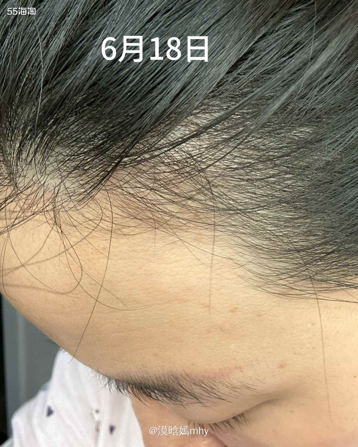 💐很荣幸被55海淘选中做为GrowGorgeous育发精华