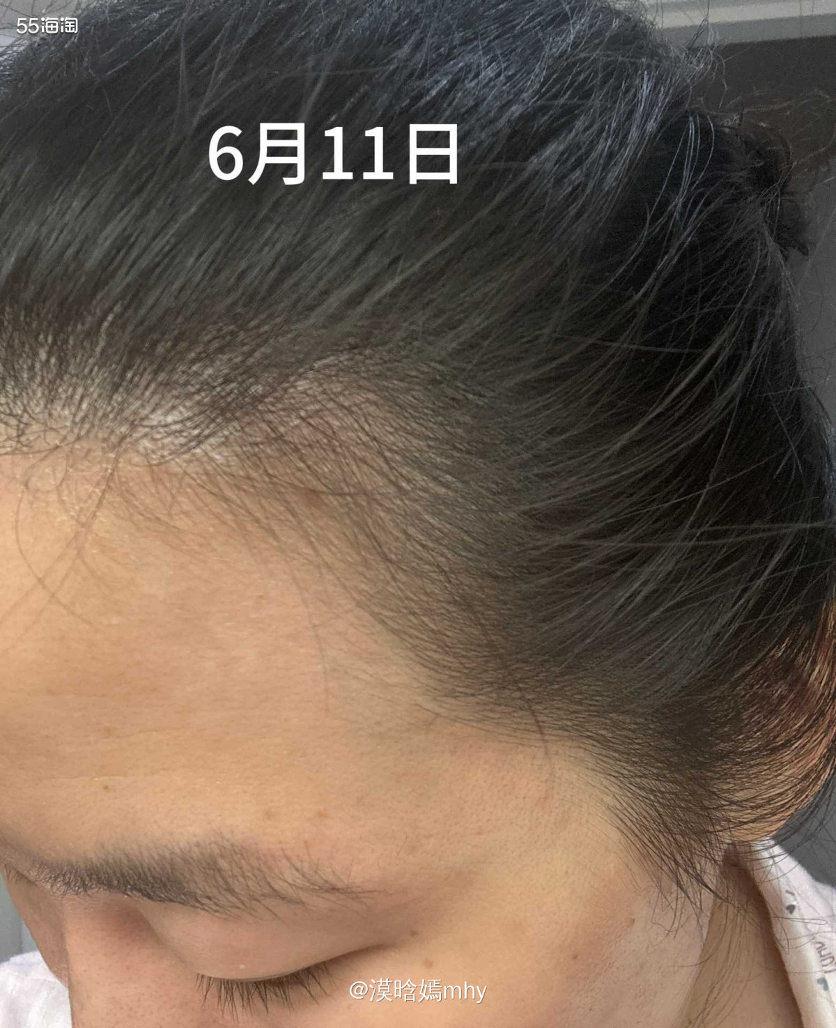 💐很荣幸被55海淘选中做为GrowGorgeous育发精华