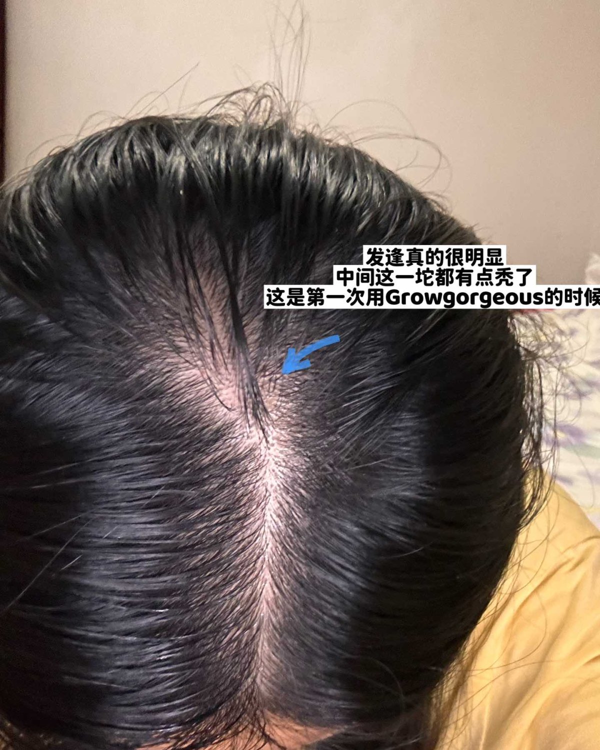 姐妹们，东非大裂谷的发缝真的有救了🥹Lookfantast