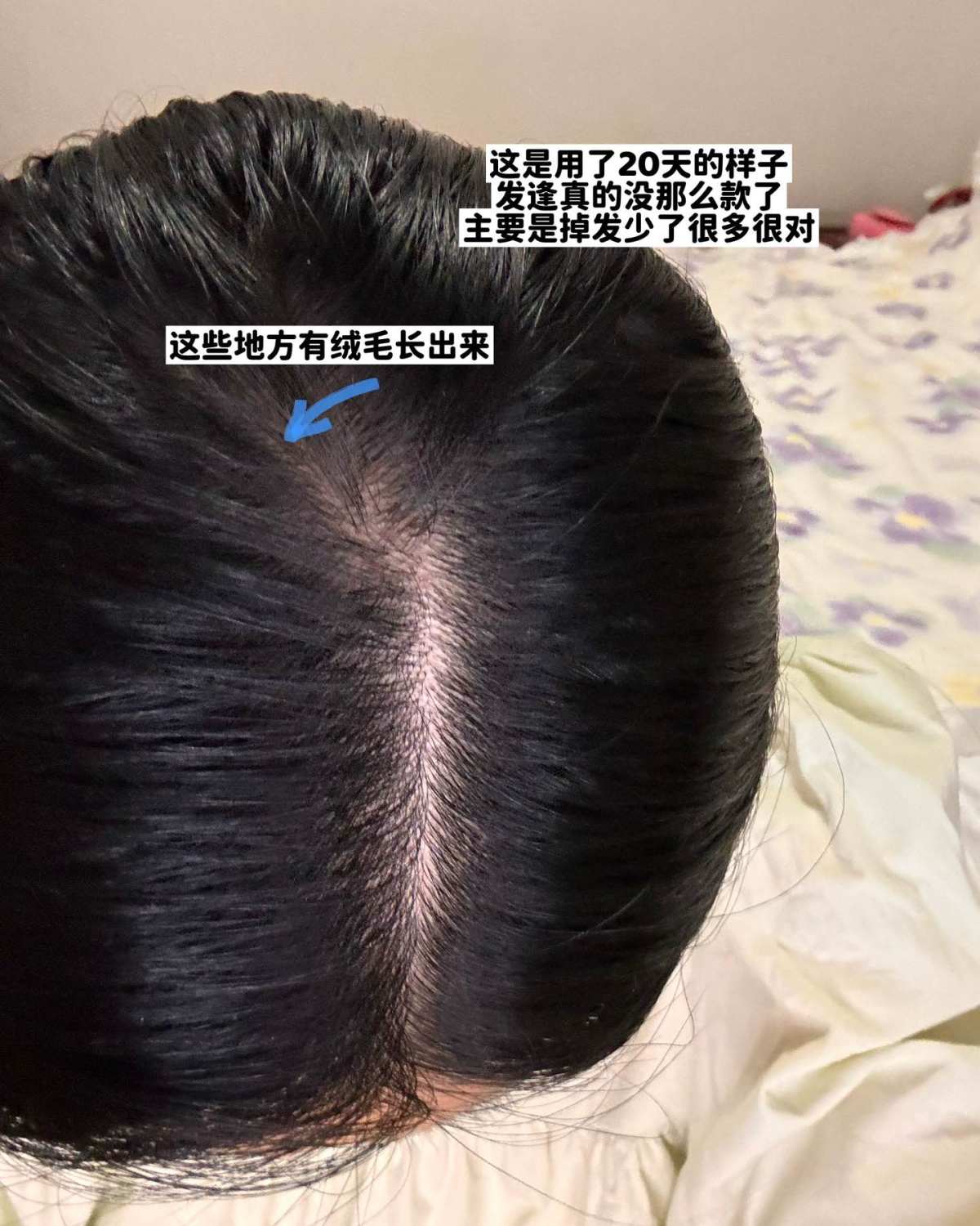 姐妹们，东非大裂谷的发缝真的有救了🥹Lookfantast