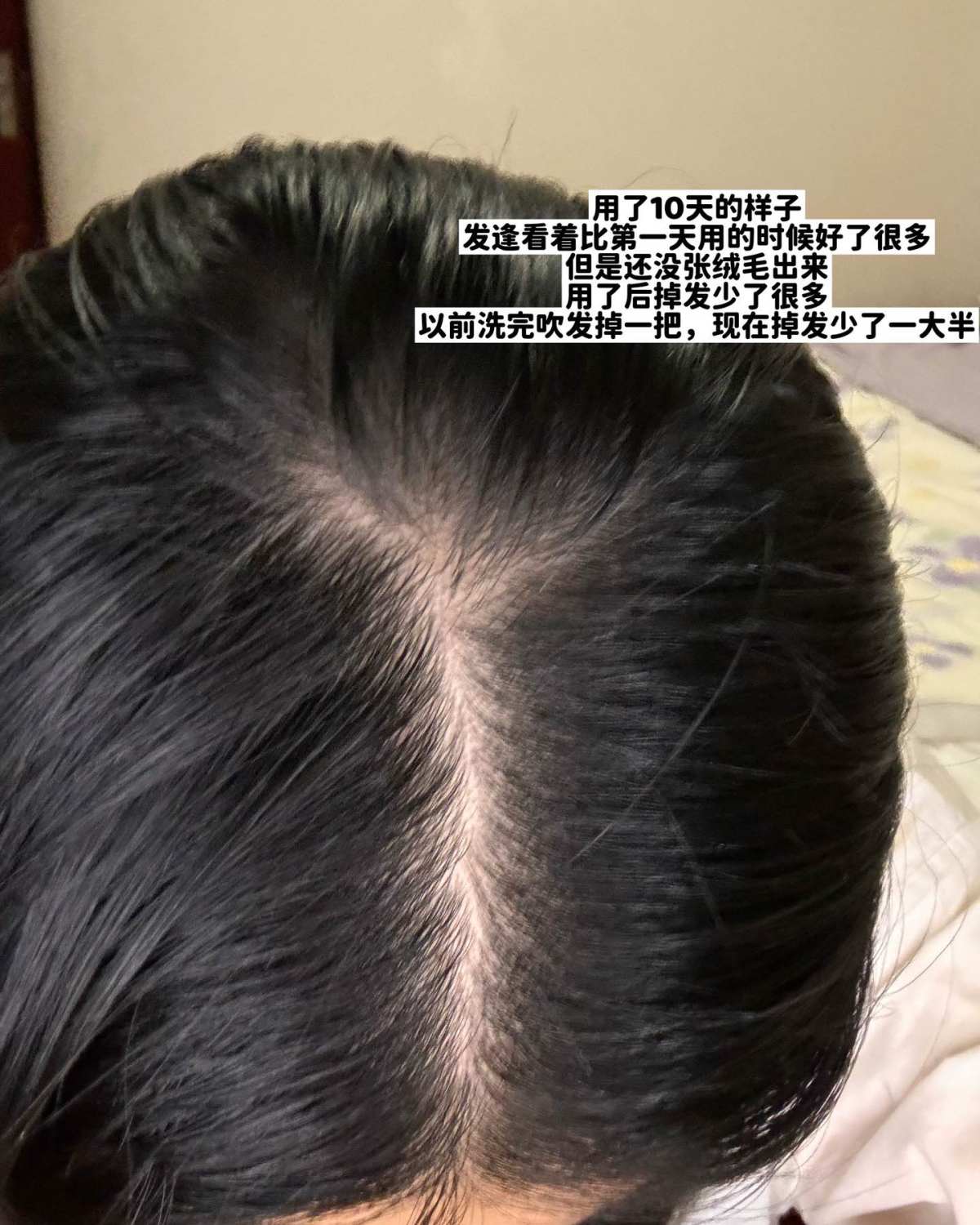 姐妹们，东非大裂谷的发缝真的有救了🥹Lookfantast