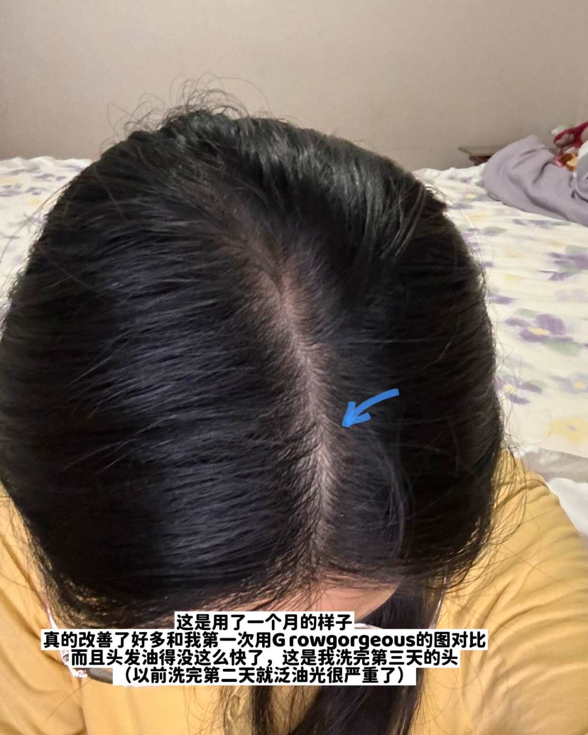 姐妹们，东非大裂谷的发缝真的有救了🥹Lookfantast